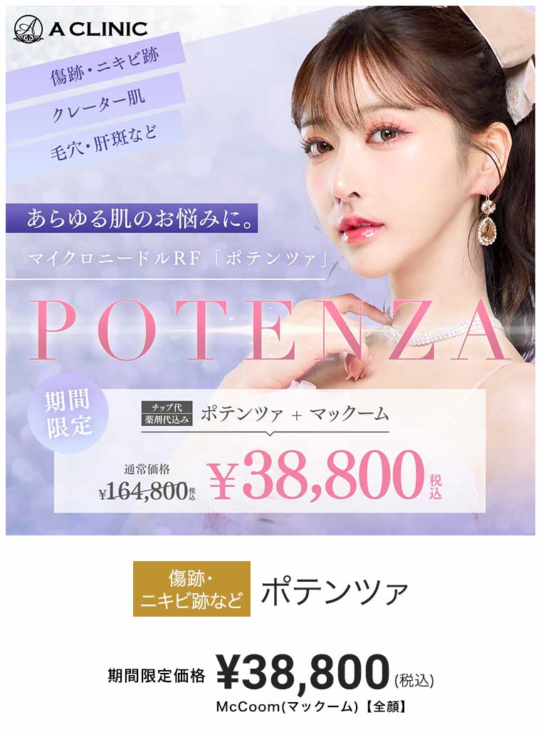 ポテンツァ